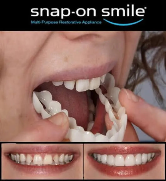 Snap-On Teeth Veneers Flexible Cosmetic Dentures for Men & Women